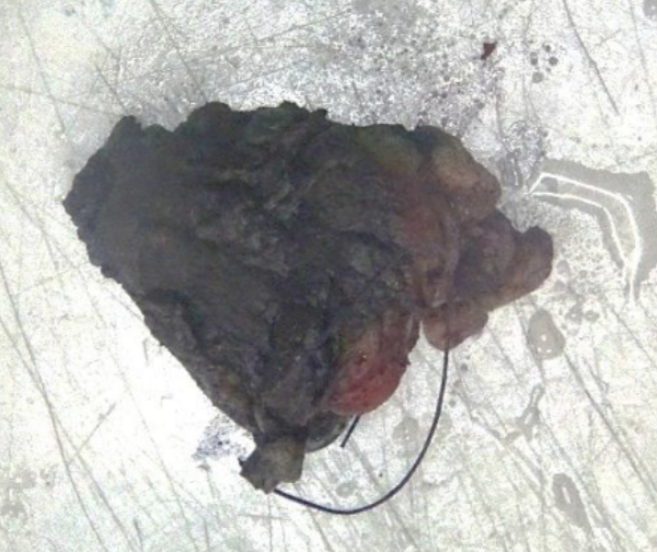 Description of the image